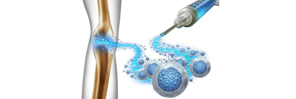 Affordable Stem Cell Treatment