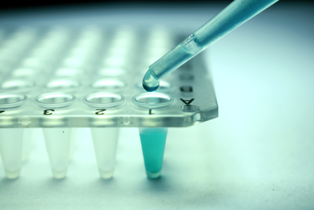 tem Cell Therapy Worth the Cost in Malaysia