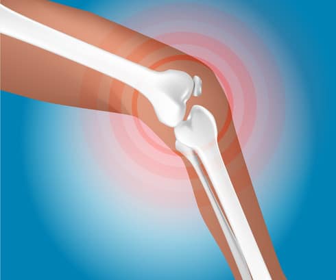 Stem Cell Treatment for Cartilage Repair