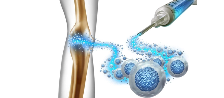 Stem Cell Clinics Malaysia